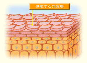 image}